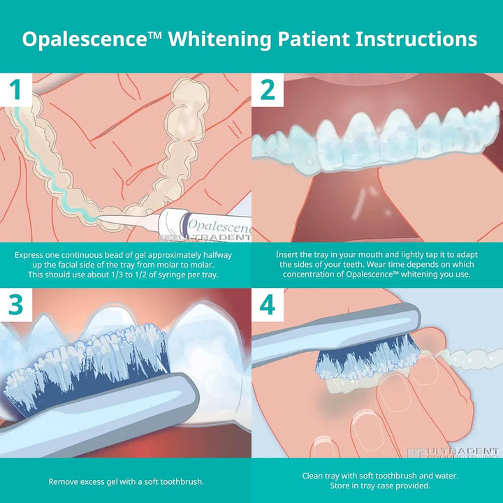 Opalescence Gel Syringes Teeth Whitening - Refill Kit (2 Packs / 4 Syringes Total) Carbamide Peroxide. Made by Ultradent, in Mint Flavor. Tooth Whitening Refill Syringes